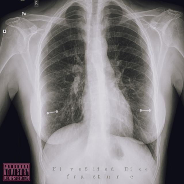 Album cover art for f r a c t u r e
