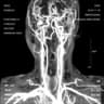 Head (feat. Punchnello)