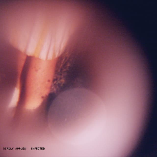 Album cover art for Infected