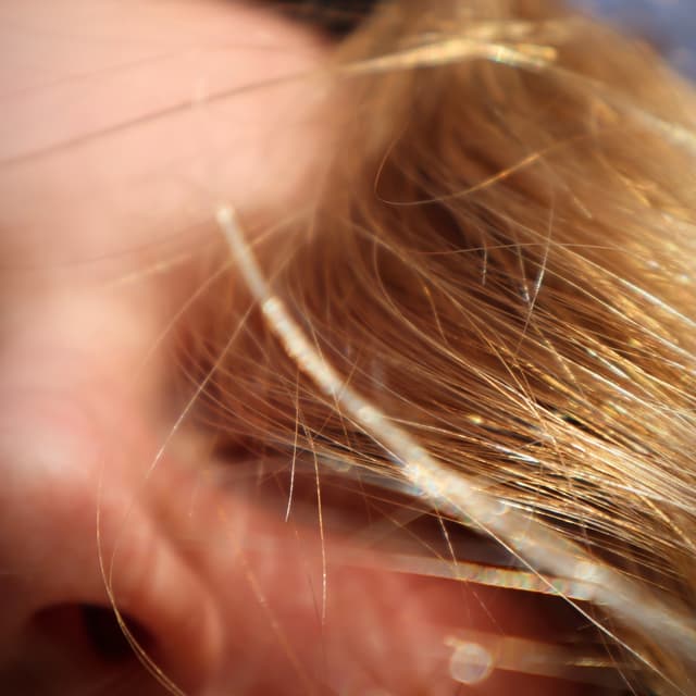 Album cover art for Golden