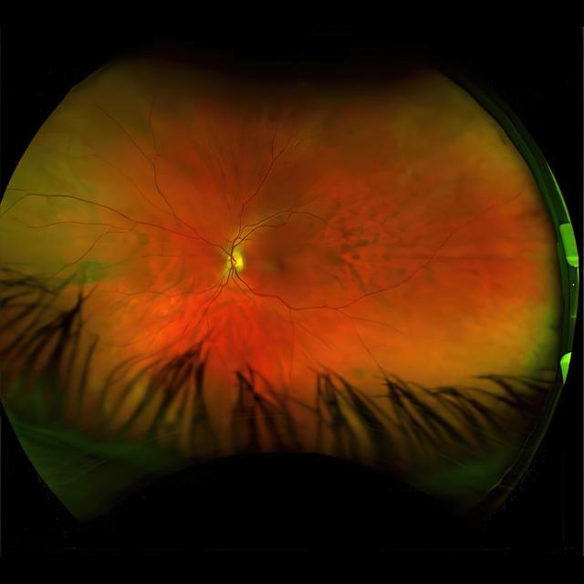 Album cover art for Mirrorcell