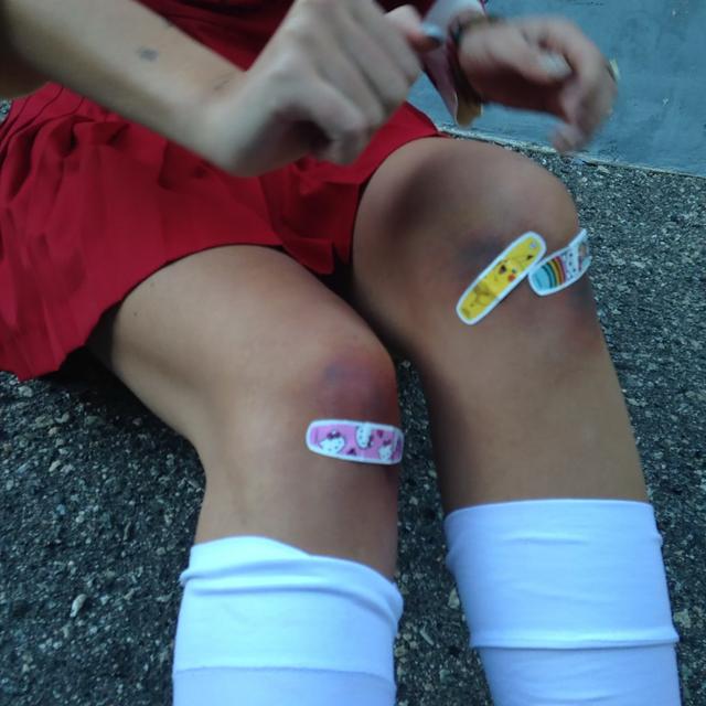 Album cover art for Bruise