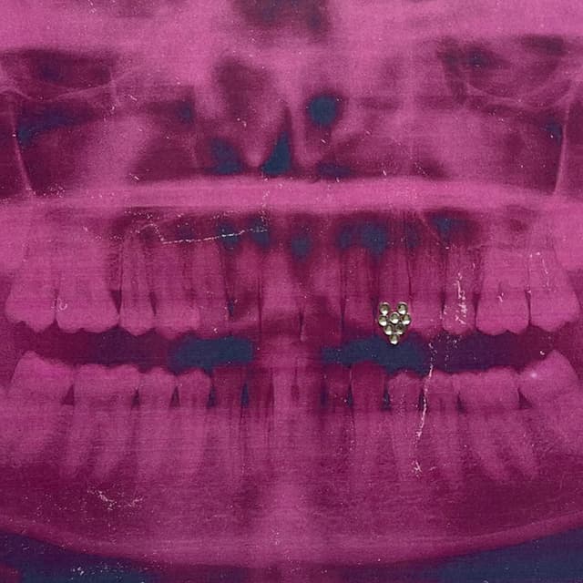 Album cover art for BRILLO EN LOS DIENTES